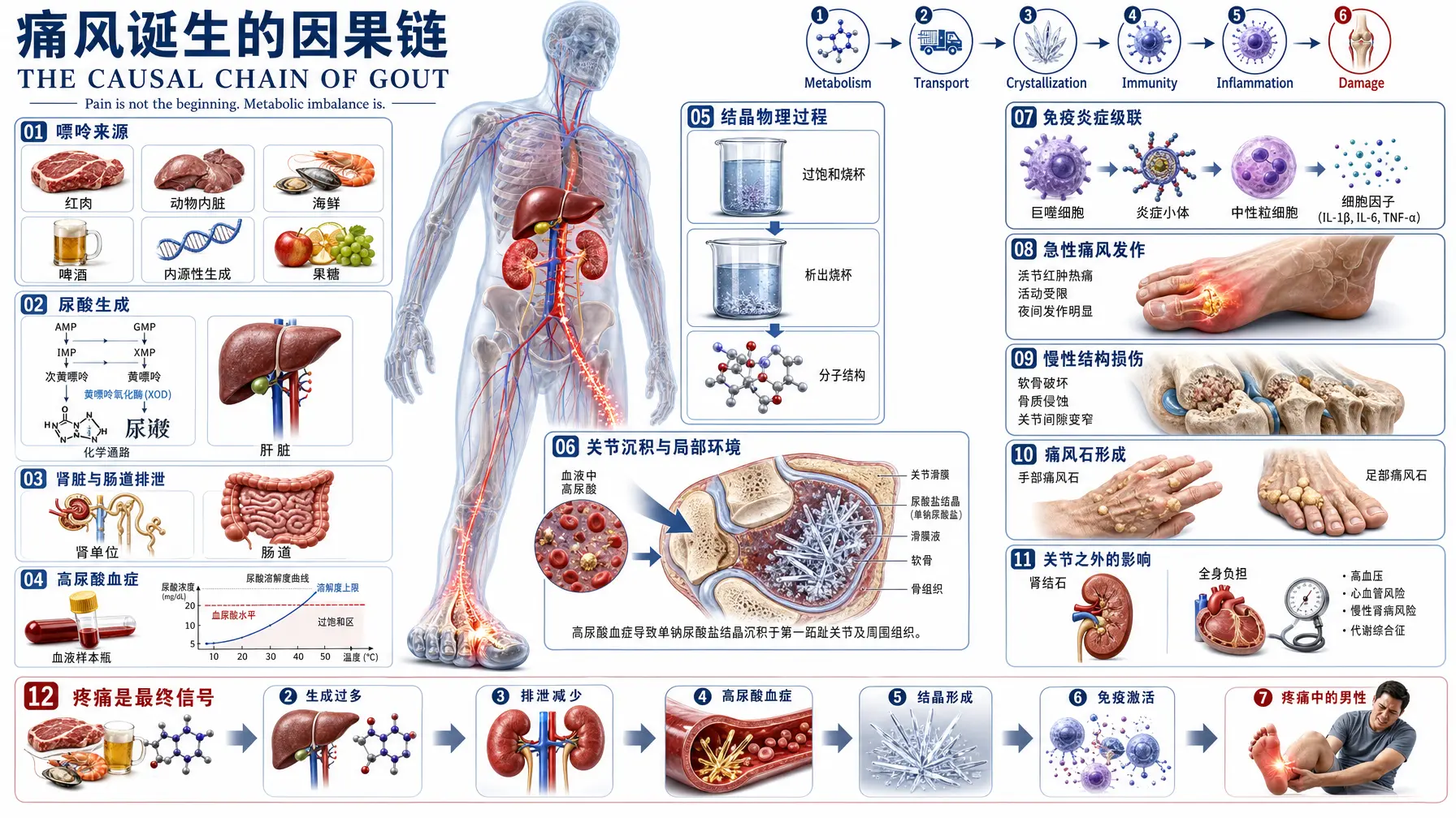 医学信息图 痛风因果链